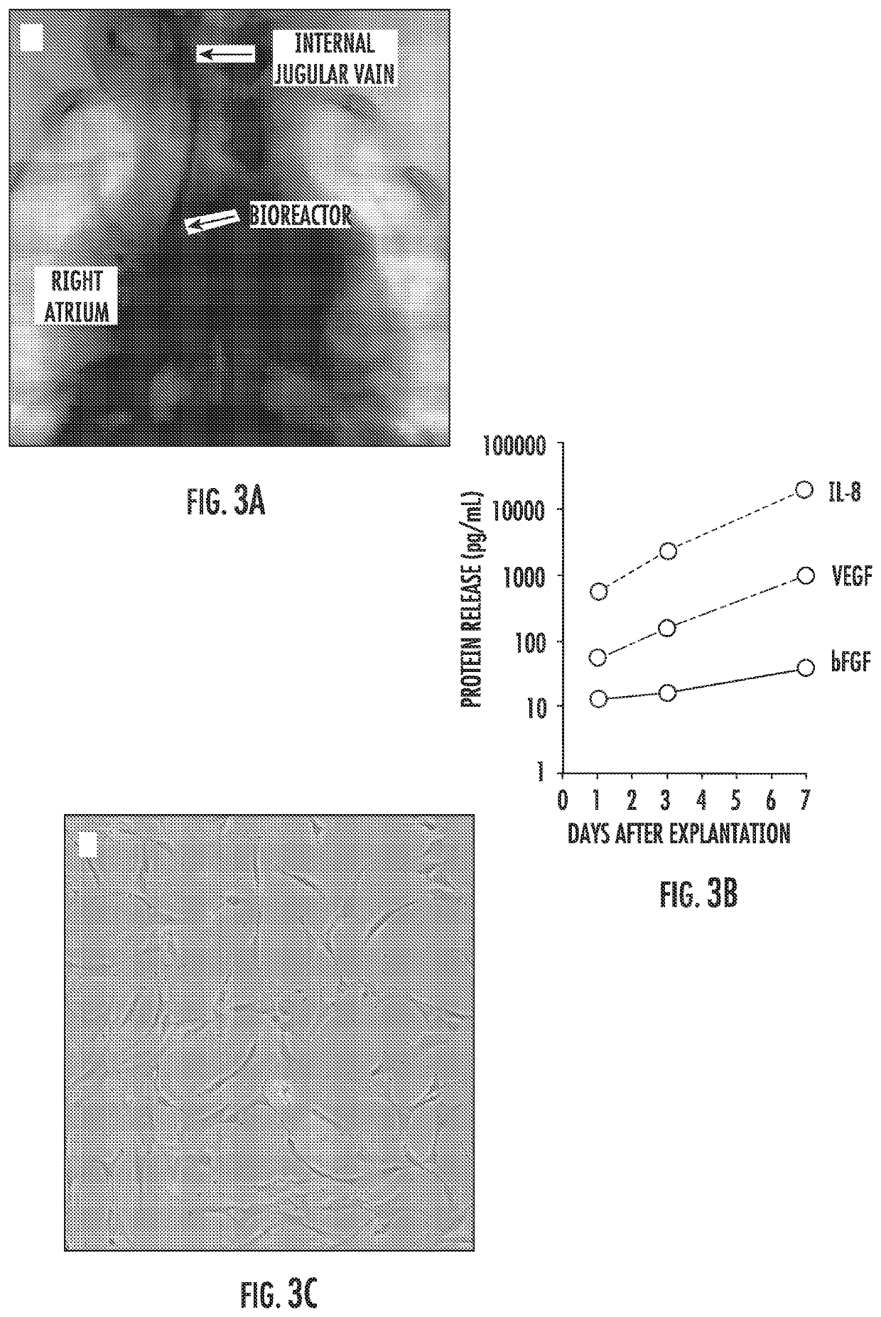 Implantable bioreactor and methods for making and using same