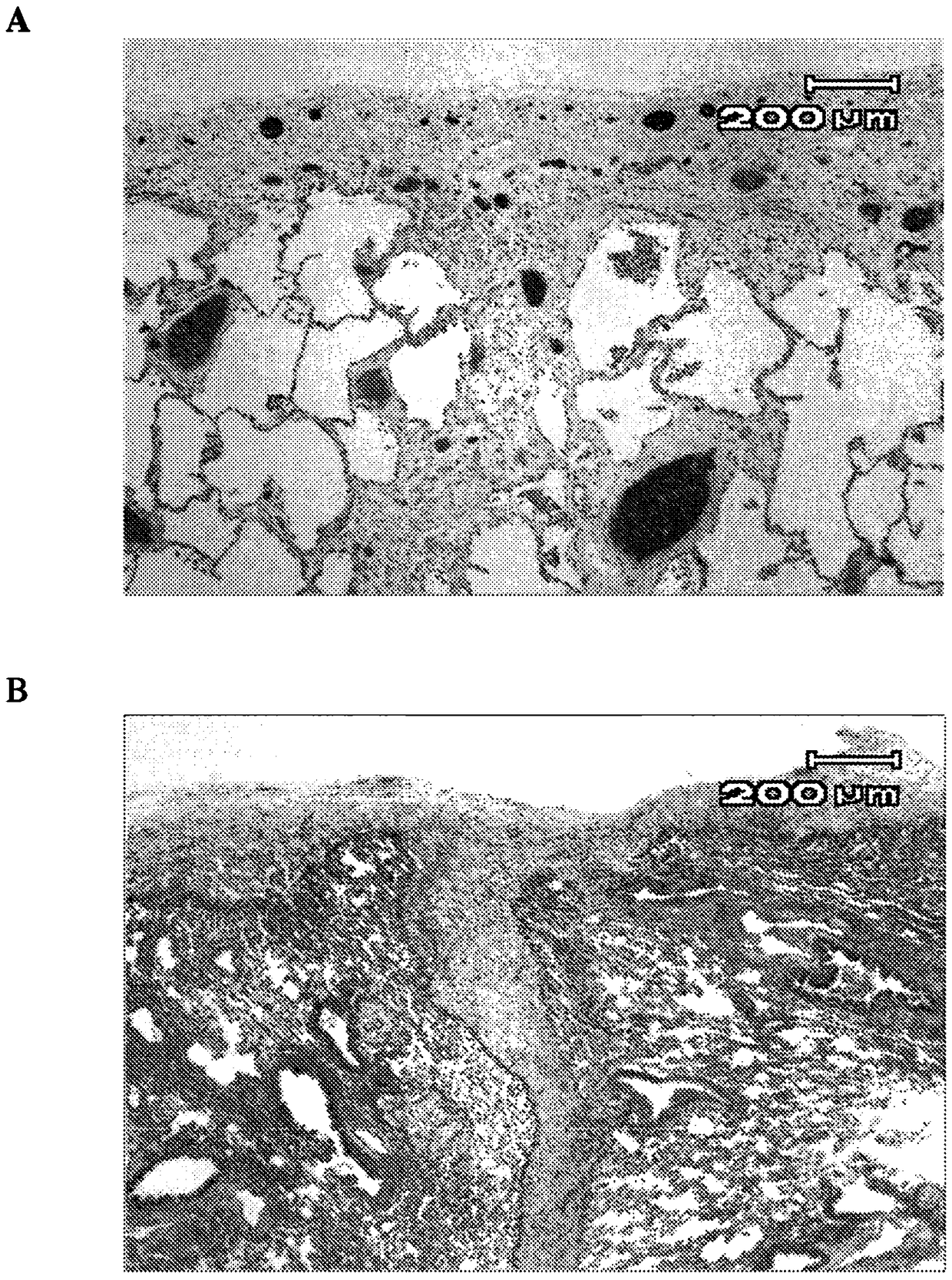 Methods for treating fibrosis