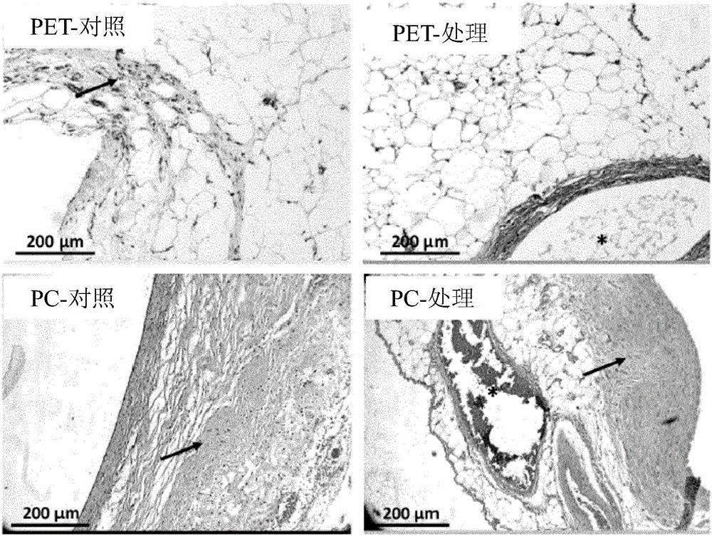 A chamber for encapsulating secreting cells