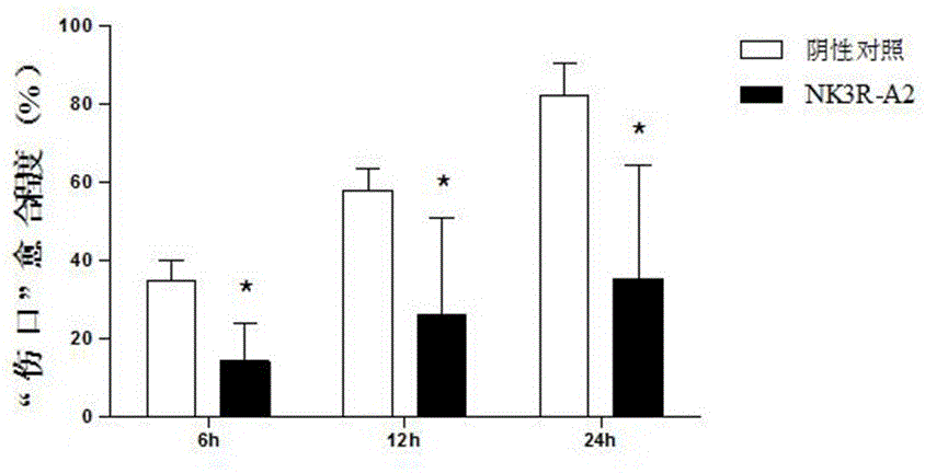 Synthetic peptide NK3R-A2 based on NK3 receptor and application thereof