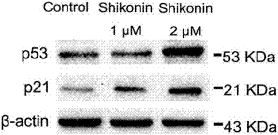 Application of shikonin in preparing drug for treating lung cancer