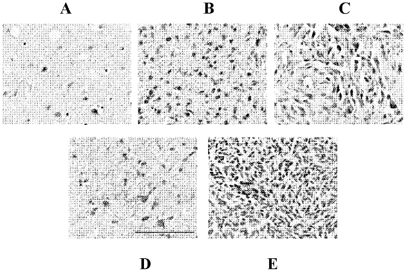 Application method of hypomethylated gene POTEH