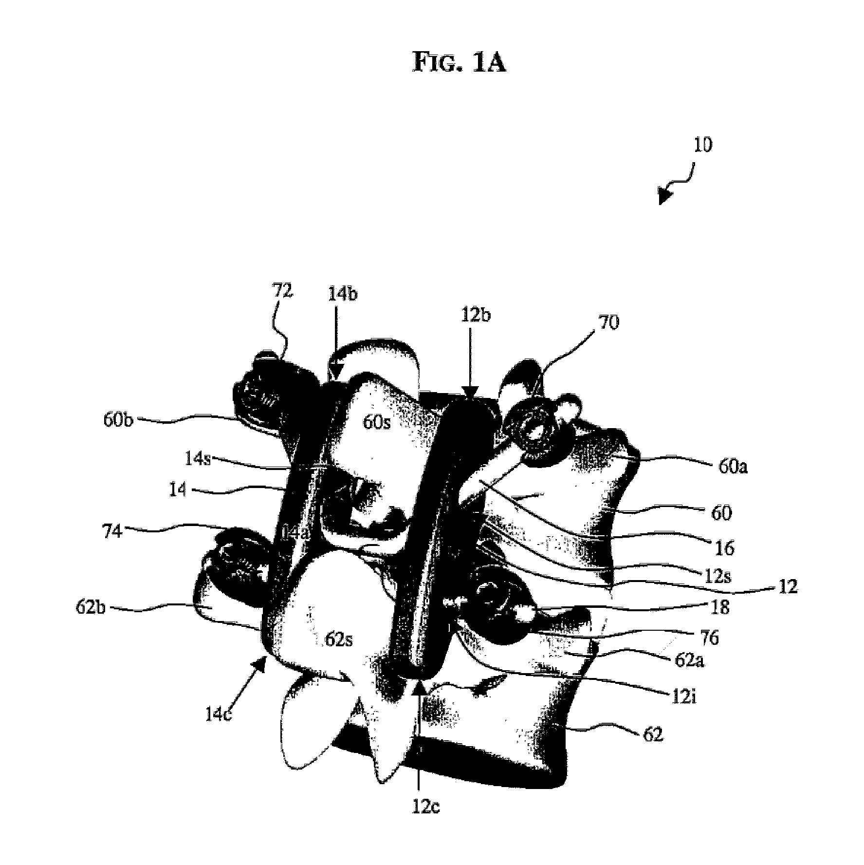 Posterior dynamic stabilizer devices