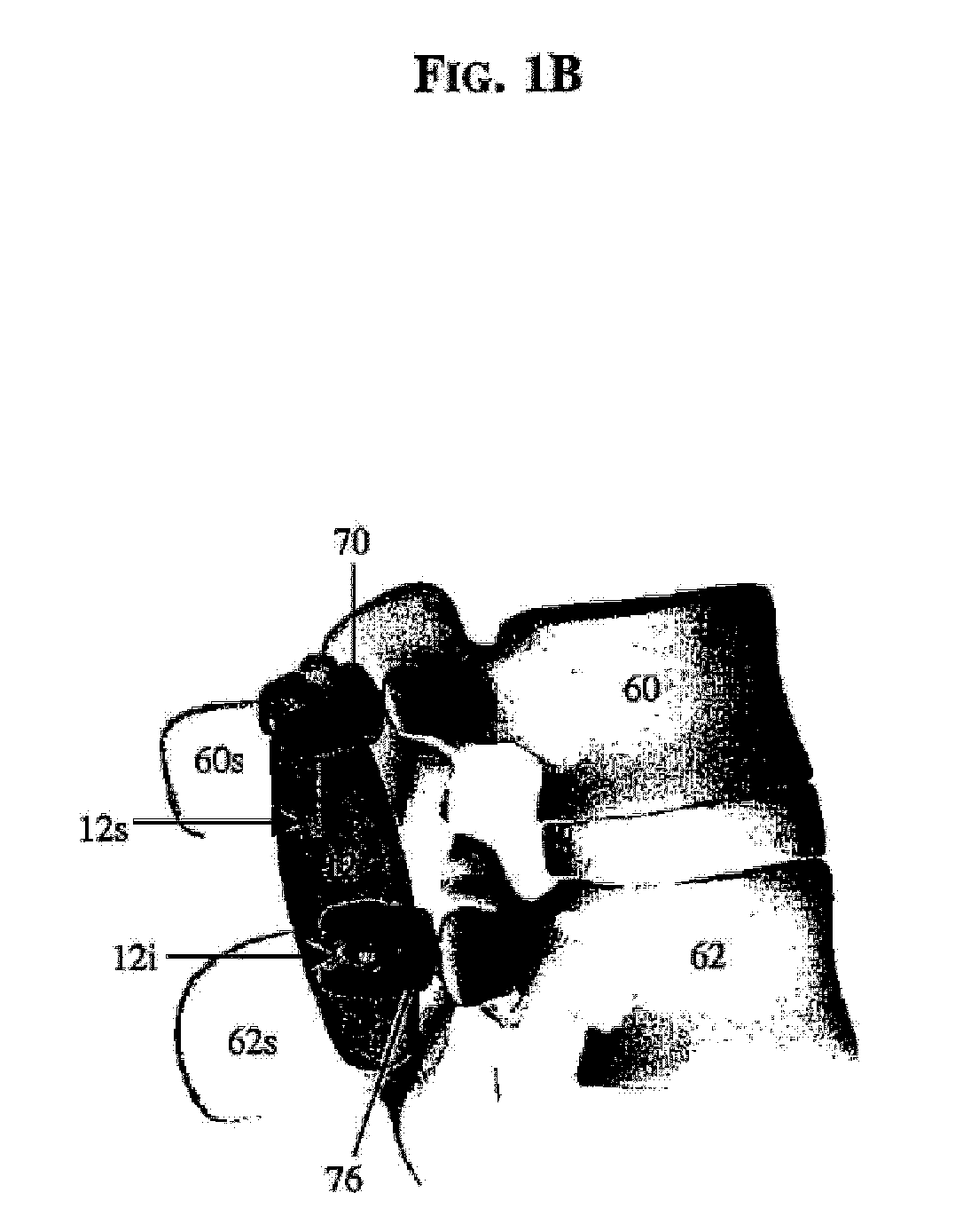 Posterior dynamic stabilizer devices