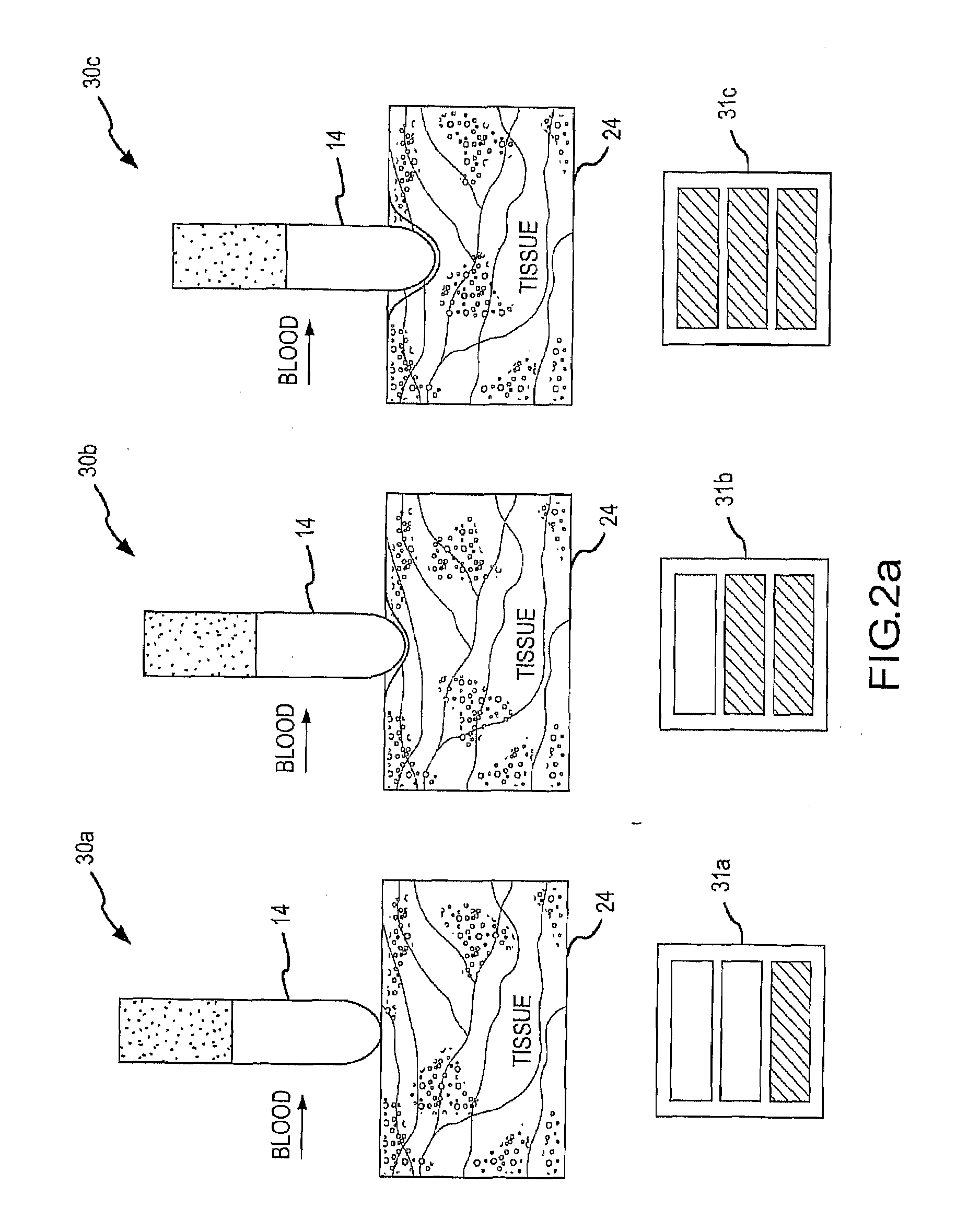 Design of Handle Set for Ablation Catheter with Indicators of Catheter and Tissue Parameters