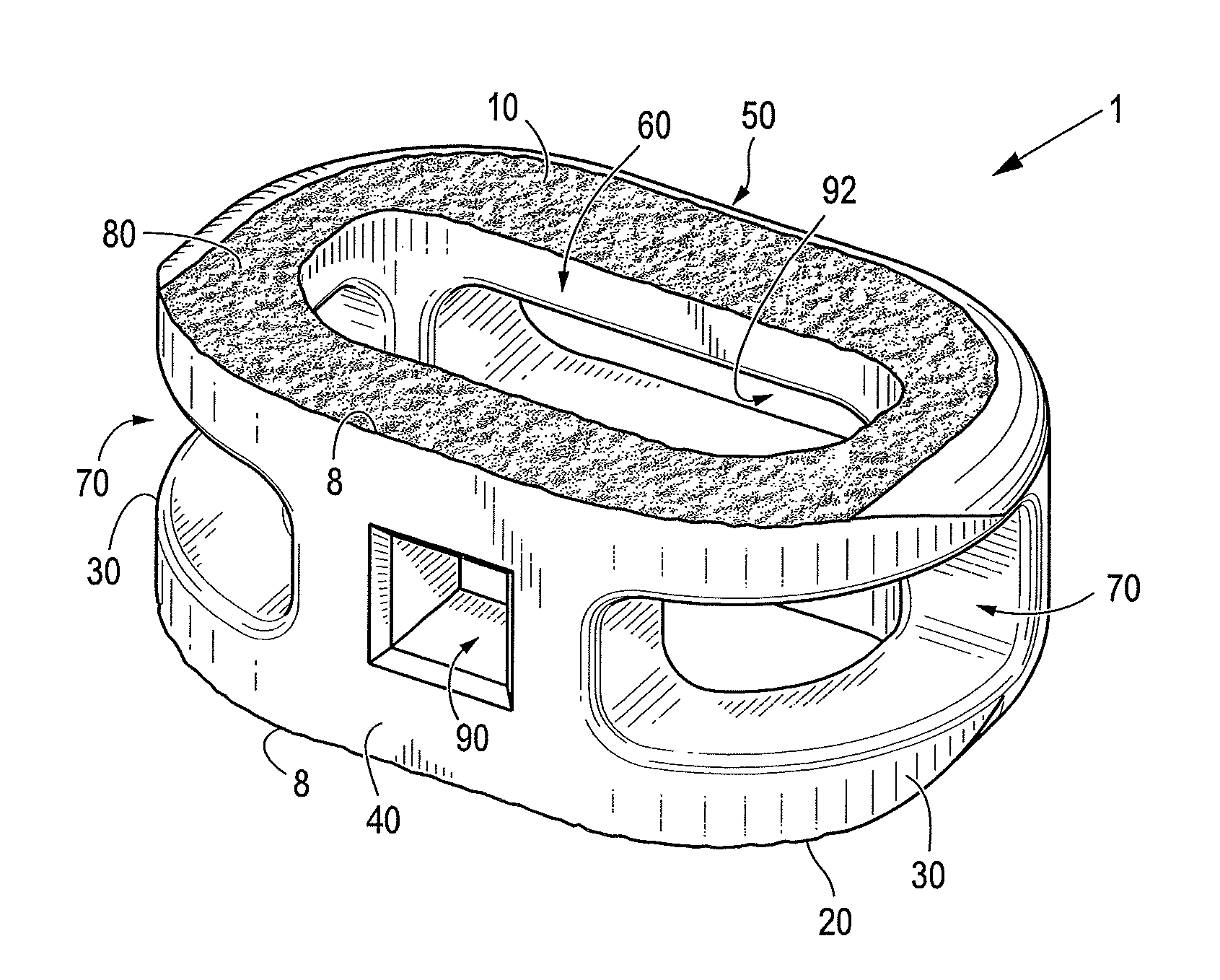 Instruments and interbody spinal implants enhancing disc space distraction