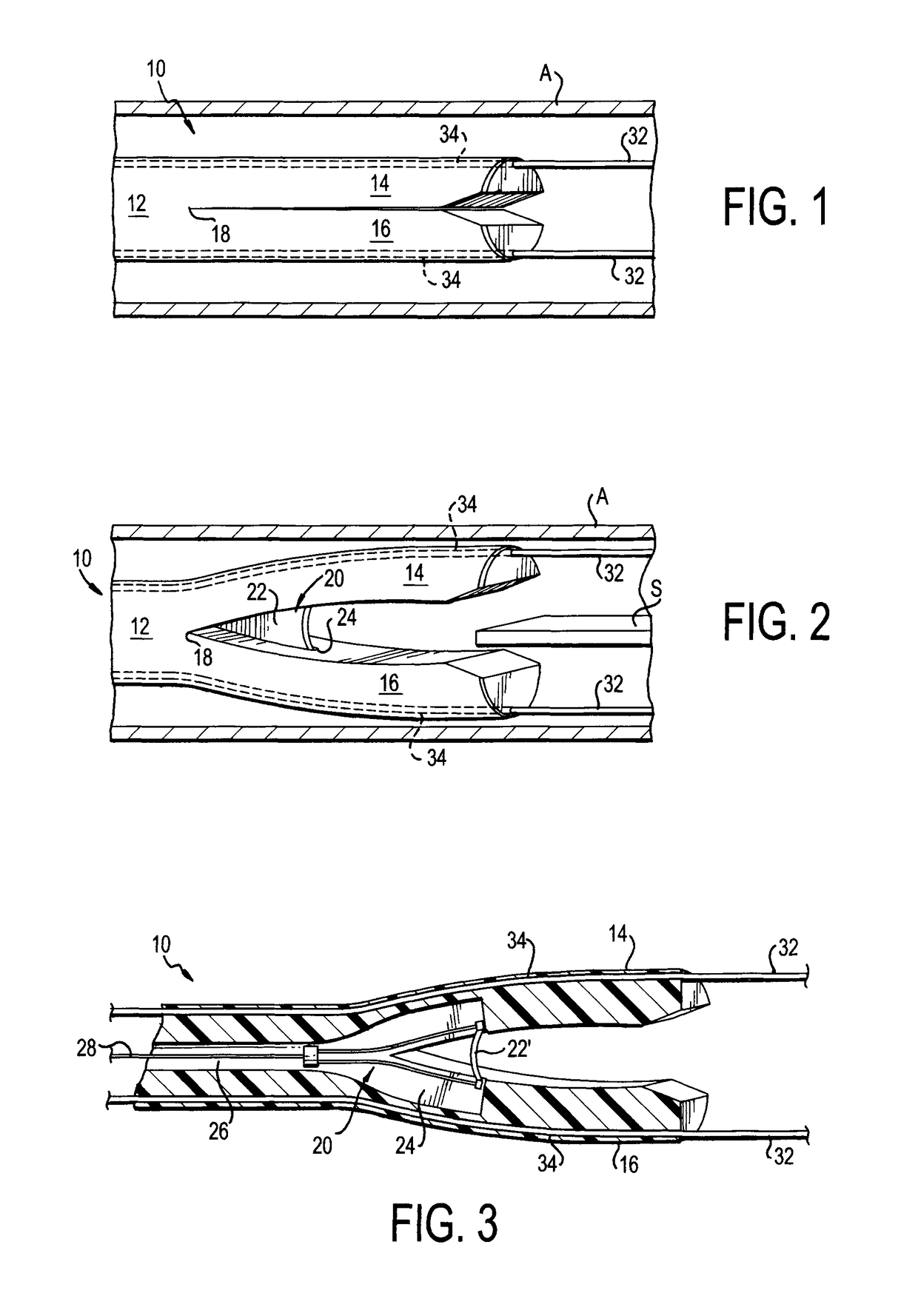 Septotomy catheter for aortic dissection