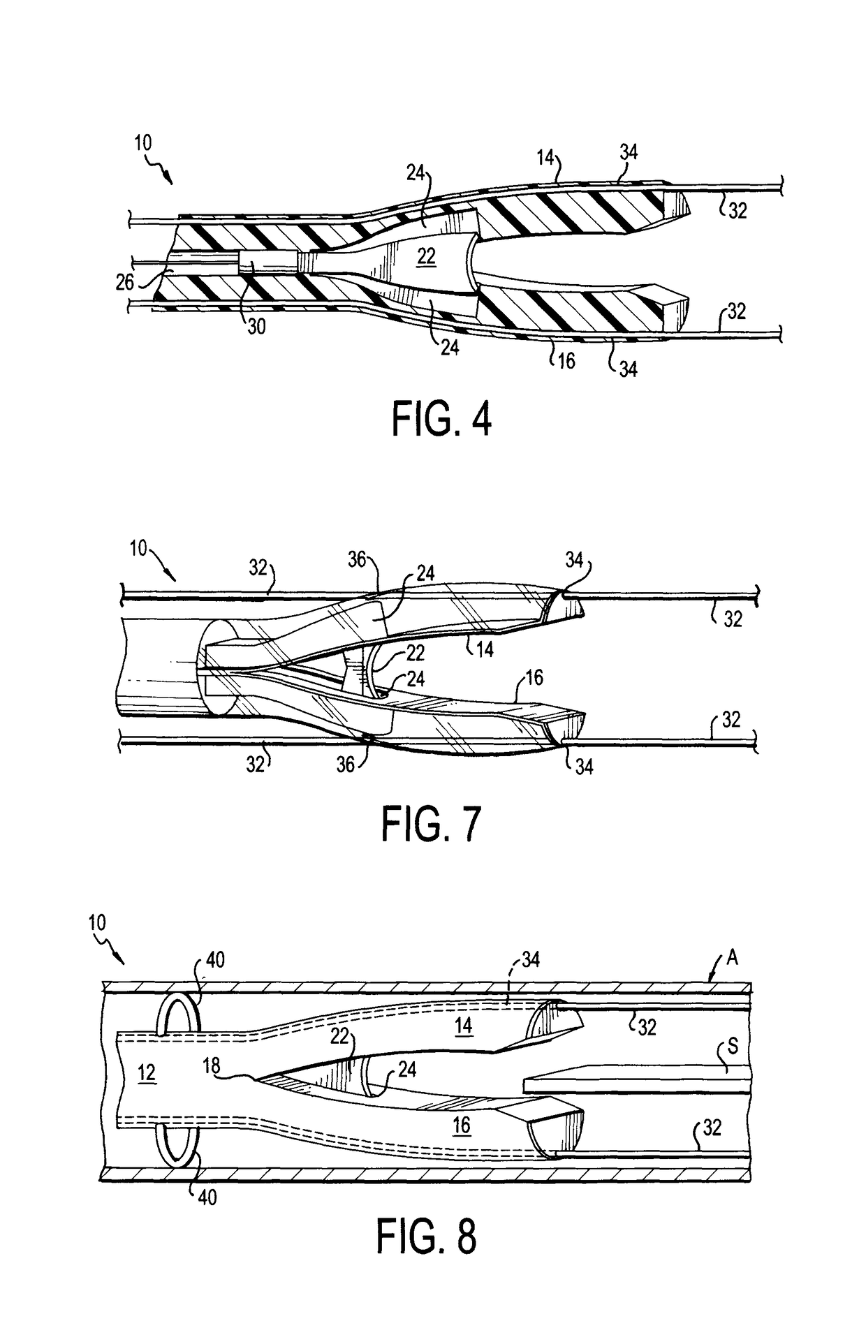 Septotomy catheter for aortic dissection