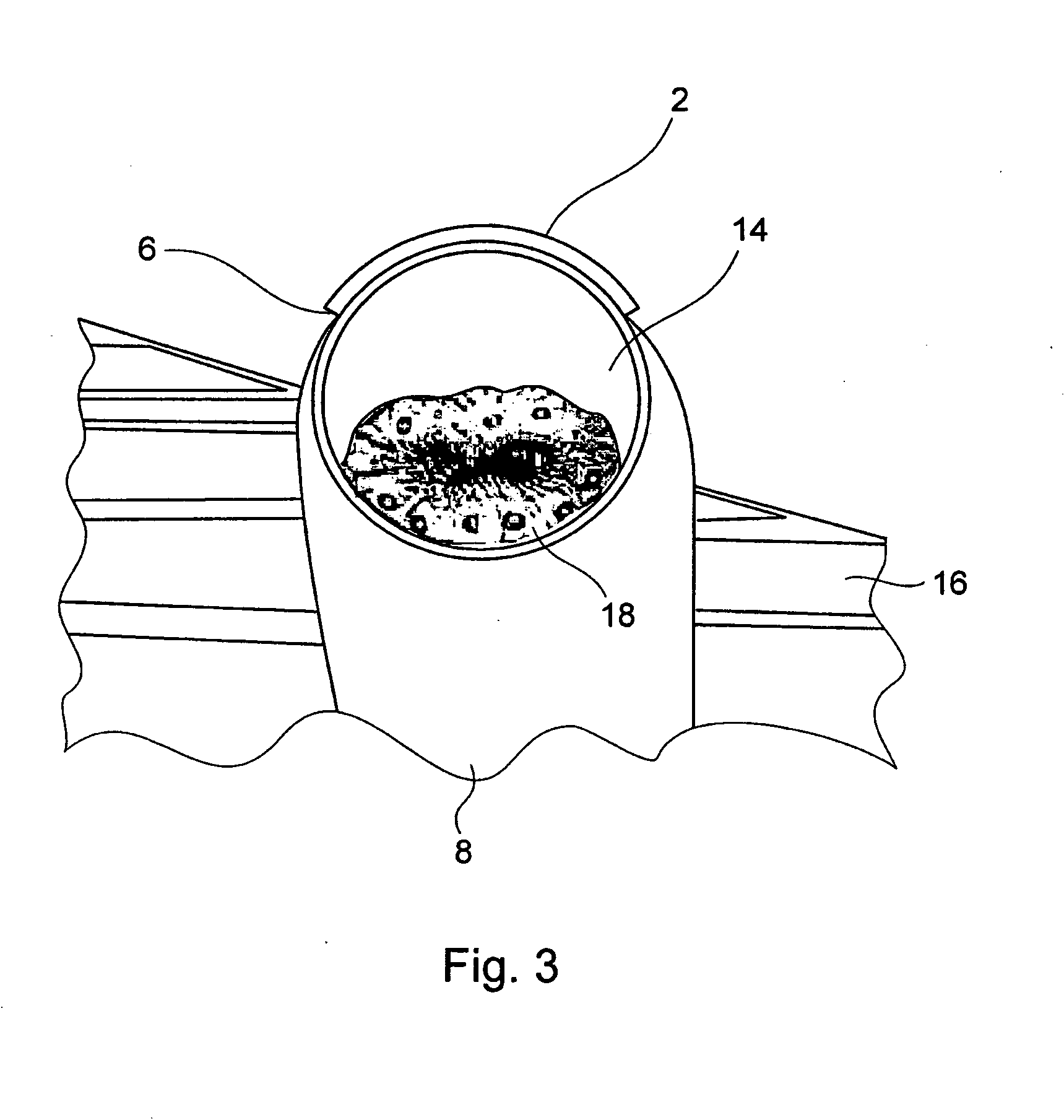 Deflection device for a stream body