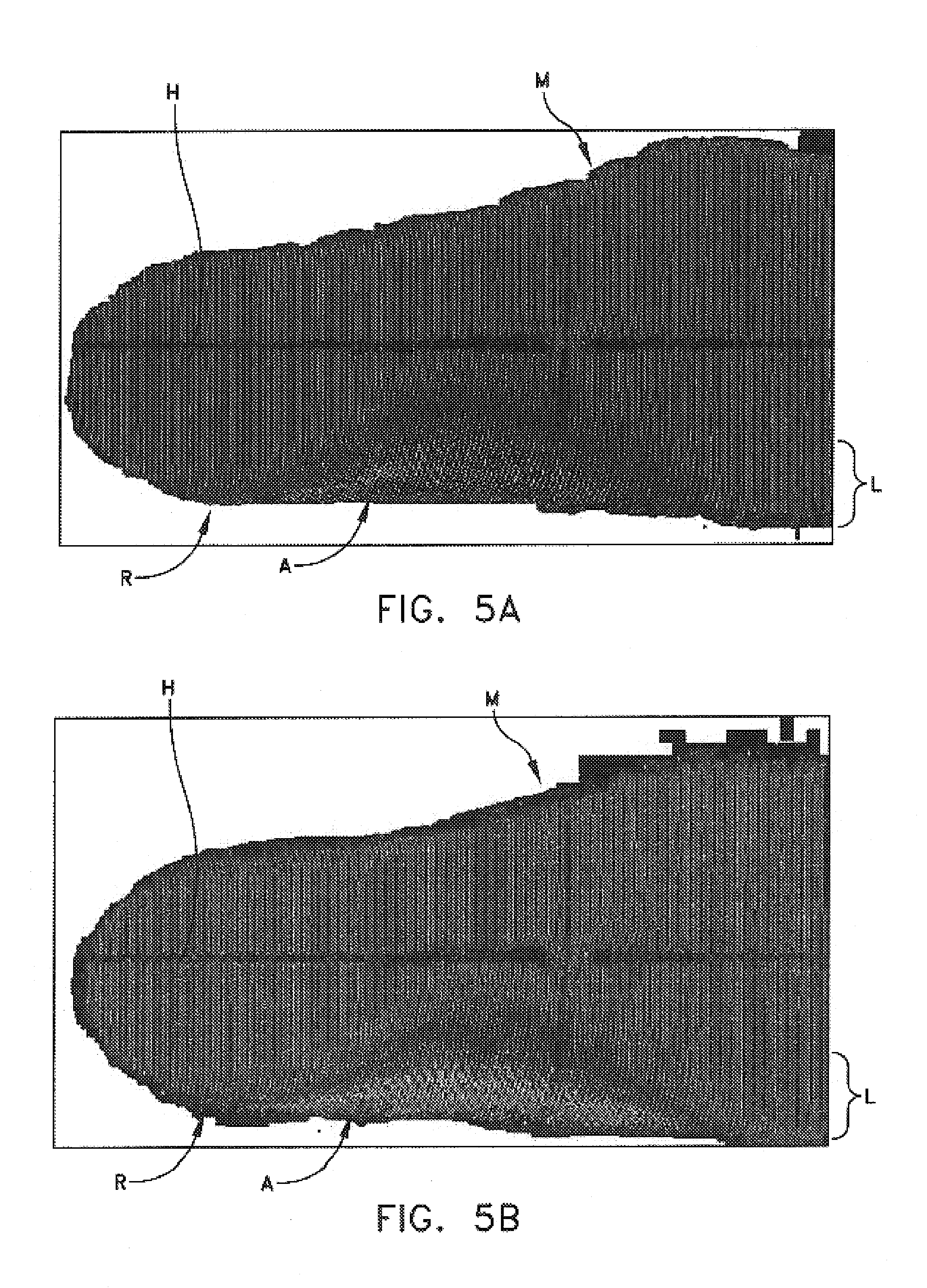 Method and apparatus for manufacturing custom orthotic footbeds