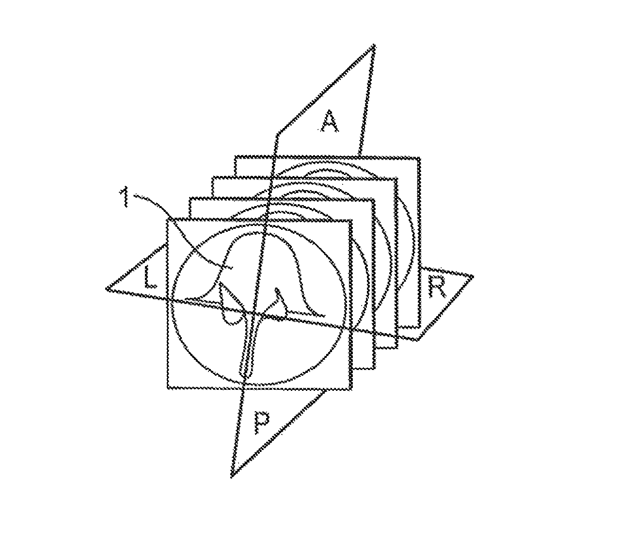 Method for verifying the relative position of bone structures