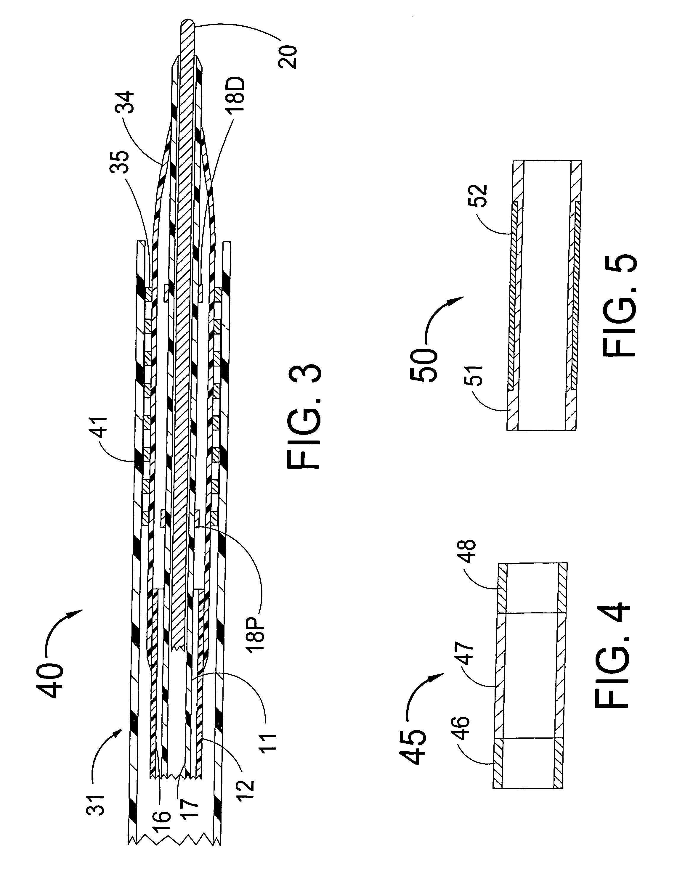 Stent with self-expanding end sections