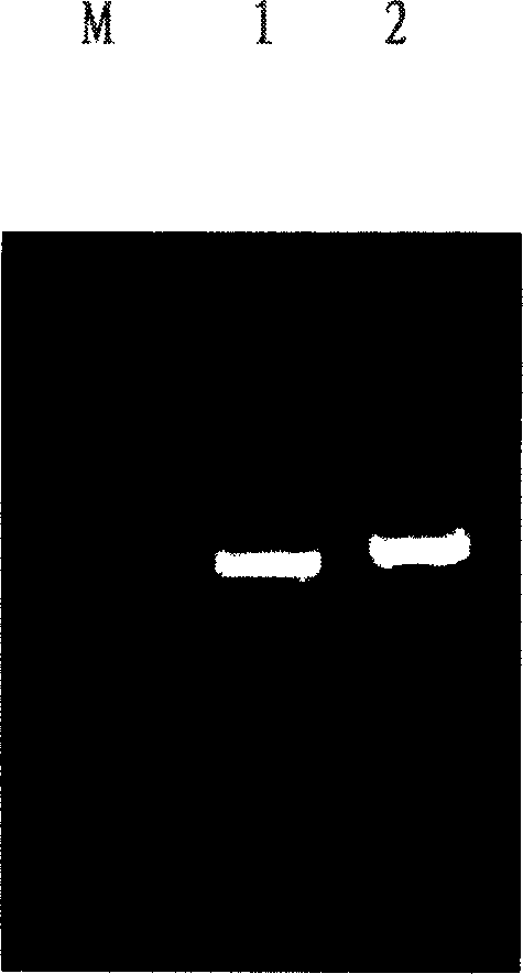 Monoclonal antibody CAb-1 heavy and light chain variable region gene of human carcinoma of large intestine, and its uses