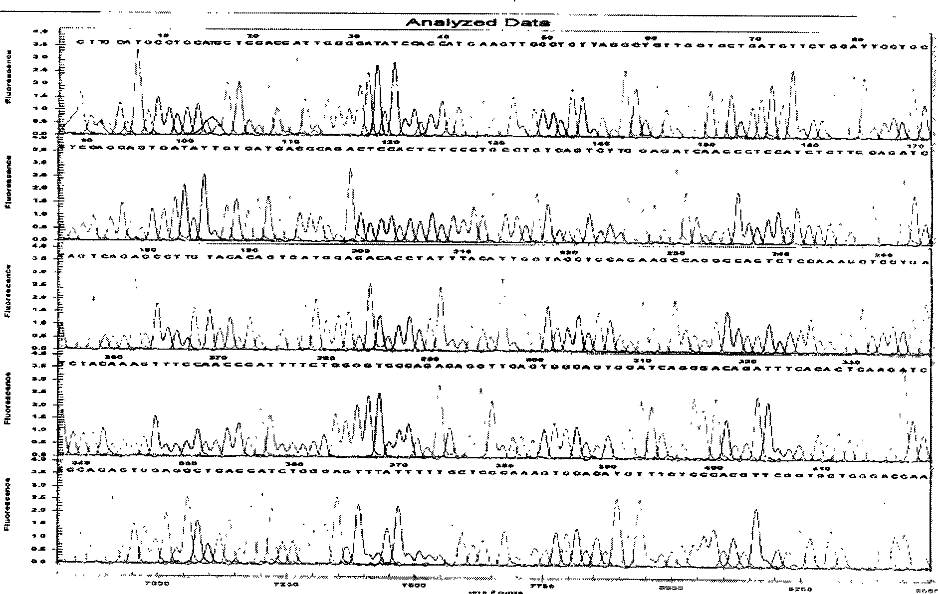 Monoclonal antibody CAb-1 heavy and light chain variable region gene of human carcinoma of large intestine, and its uses