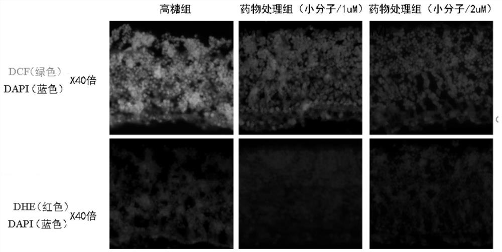 Flavonoid derivatives with rock kinase inhibitory effect