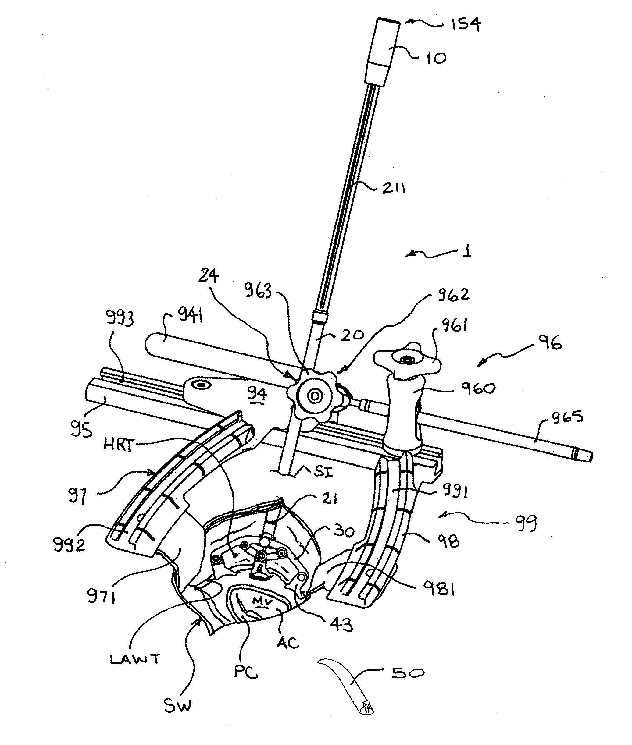 Cardiac tissue retractor with associated valve cusp depressor