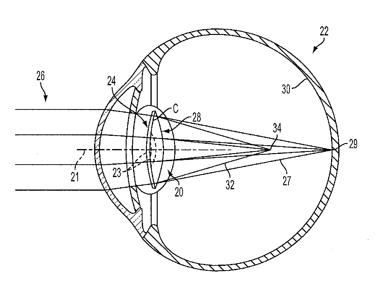 Multifocal lens having an optical add power progression, and a system and method of providing same