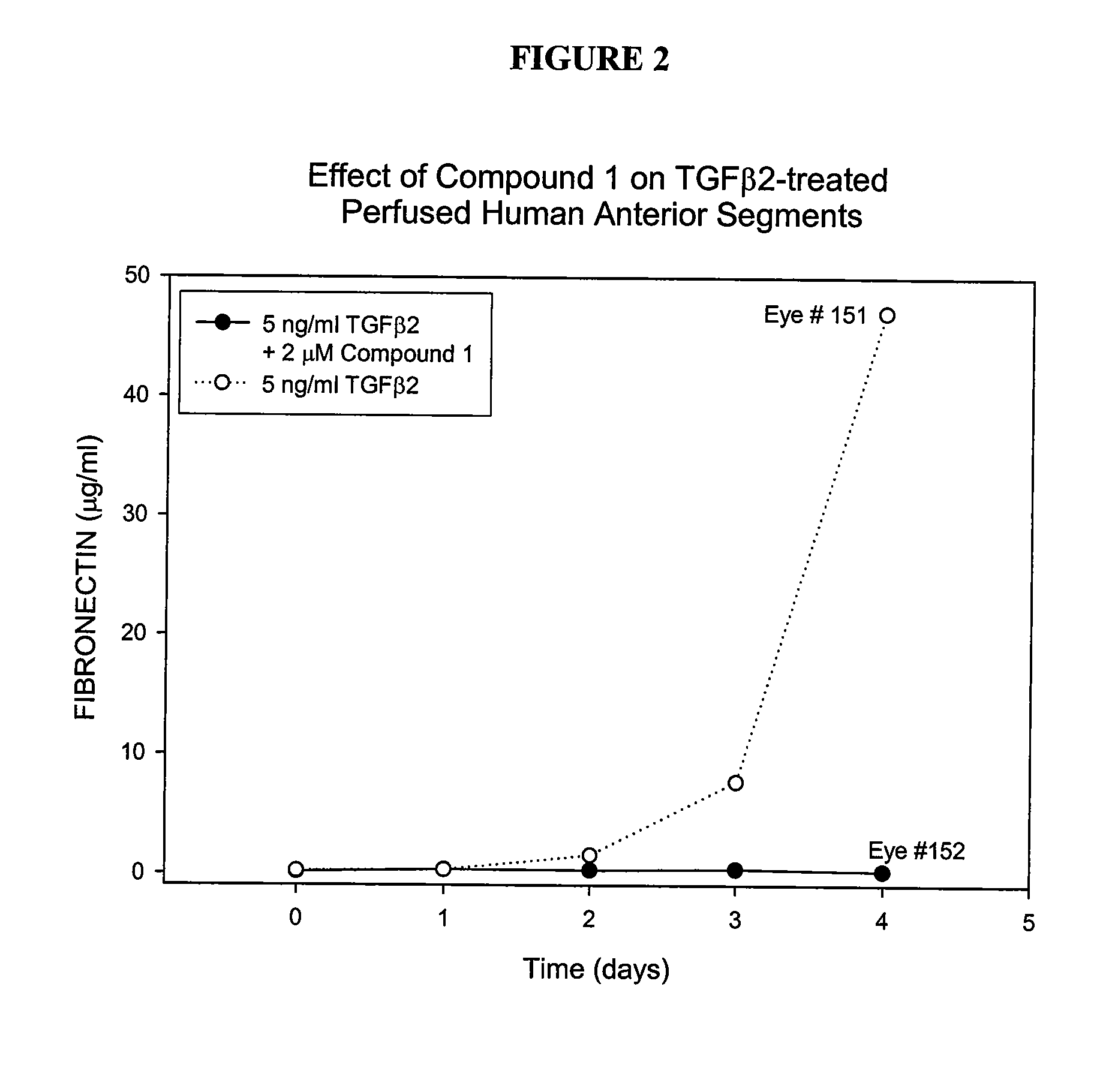 Control of intraocular pressure using ALK5 modulation agents