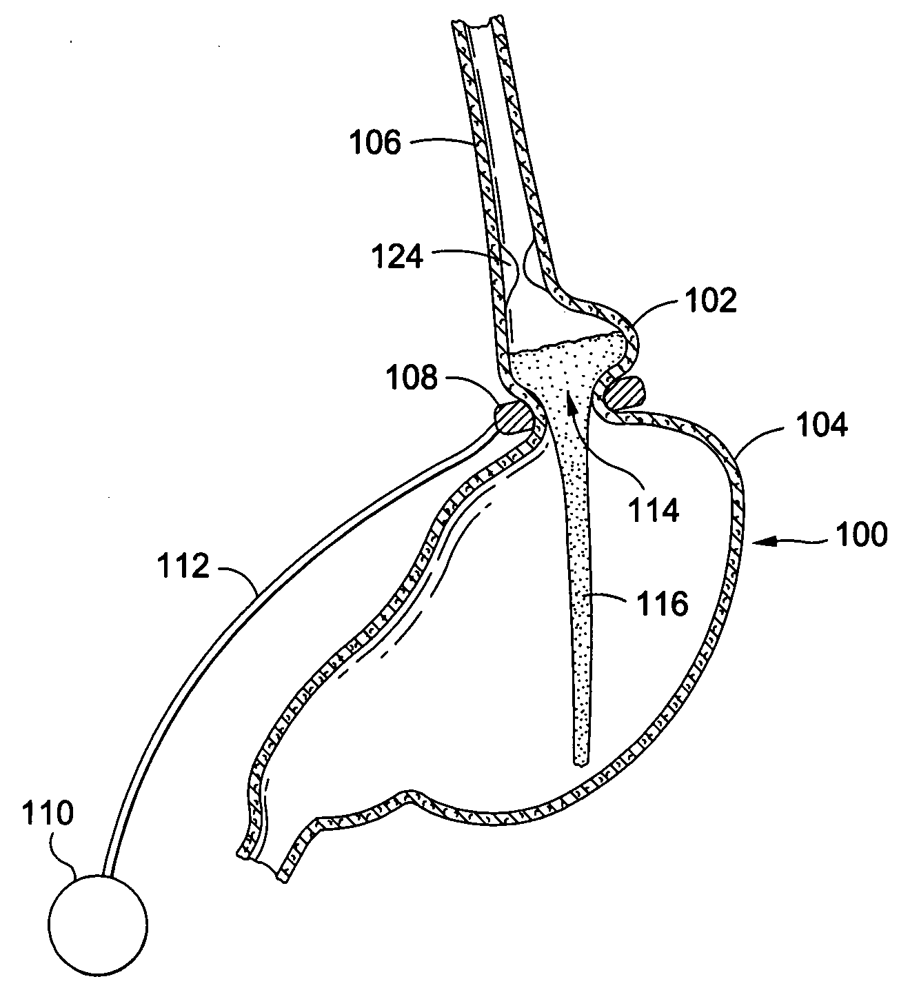 External sensing system for gastric restriction devices