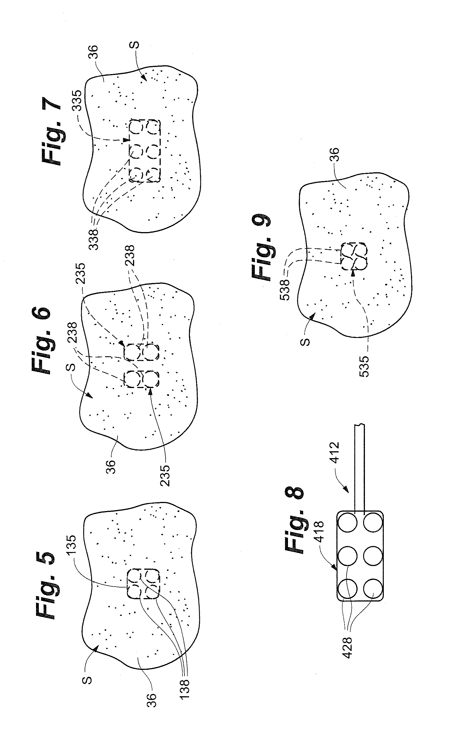 Methods of using high intensity focused ultrasound to form an ablated tissue area containing a plurality of lesions