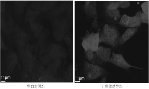 Preparation method and application of nervous system neoplasm cell autophagosome to preparing vaccine