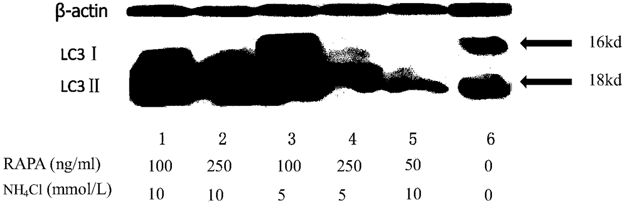 Preparation method and application of nervous system neoplasm cell autophagosome to preparing vaccine