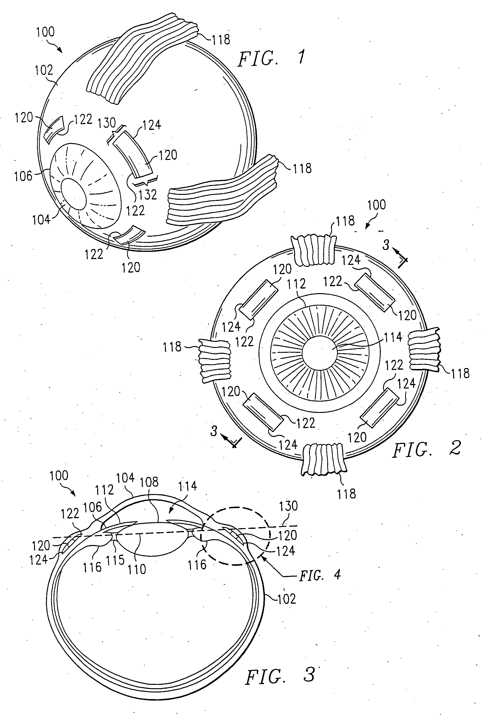 Surgical blade for use with a surgical tool for making incisions for scleral eye implants