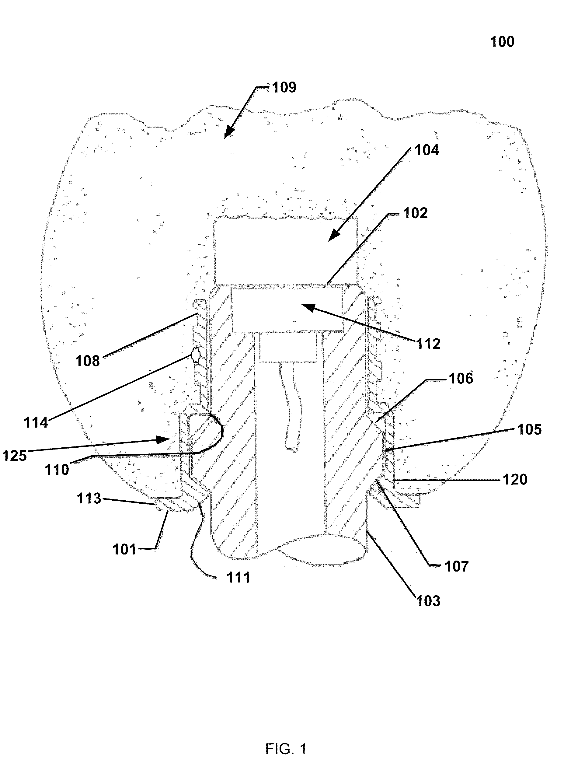 Sensor shield retention device and system