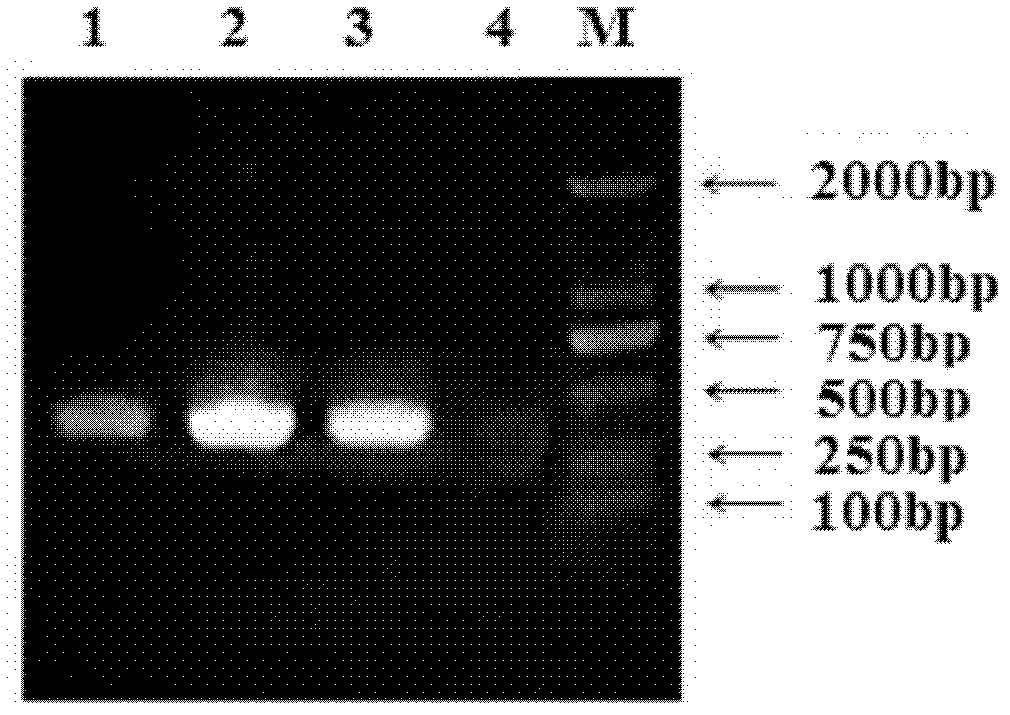 Anti-Japanese encephalitis virus monoclonal antibody and its application