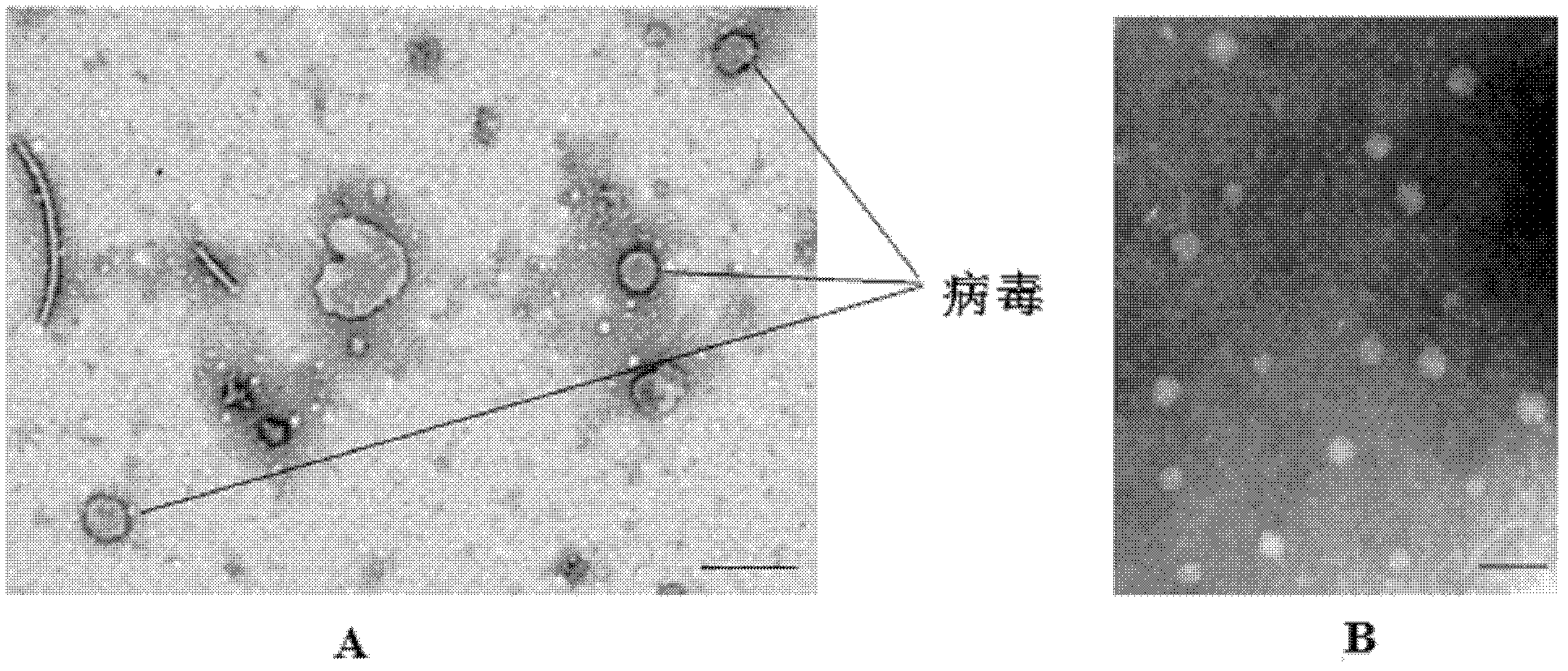 Anti-Japanese encephalitis virus monoclonal antibody and its application