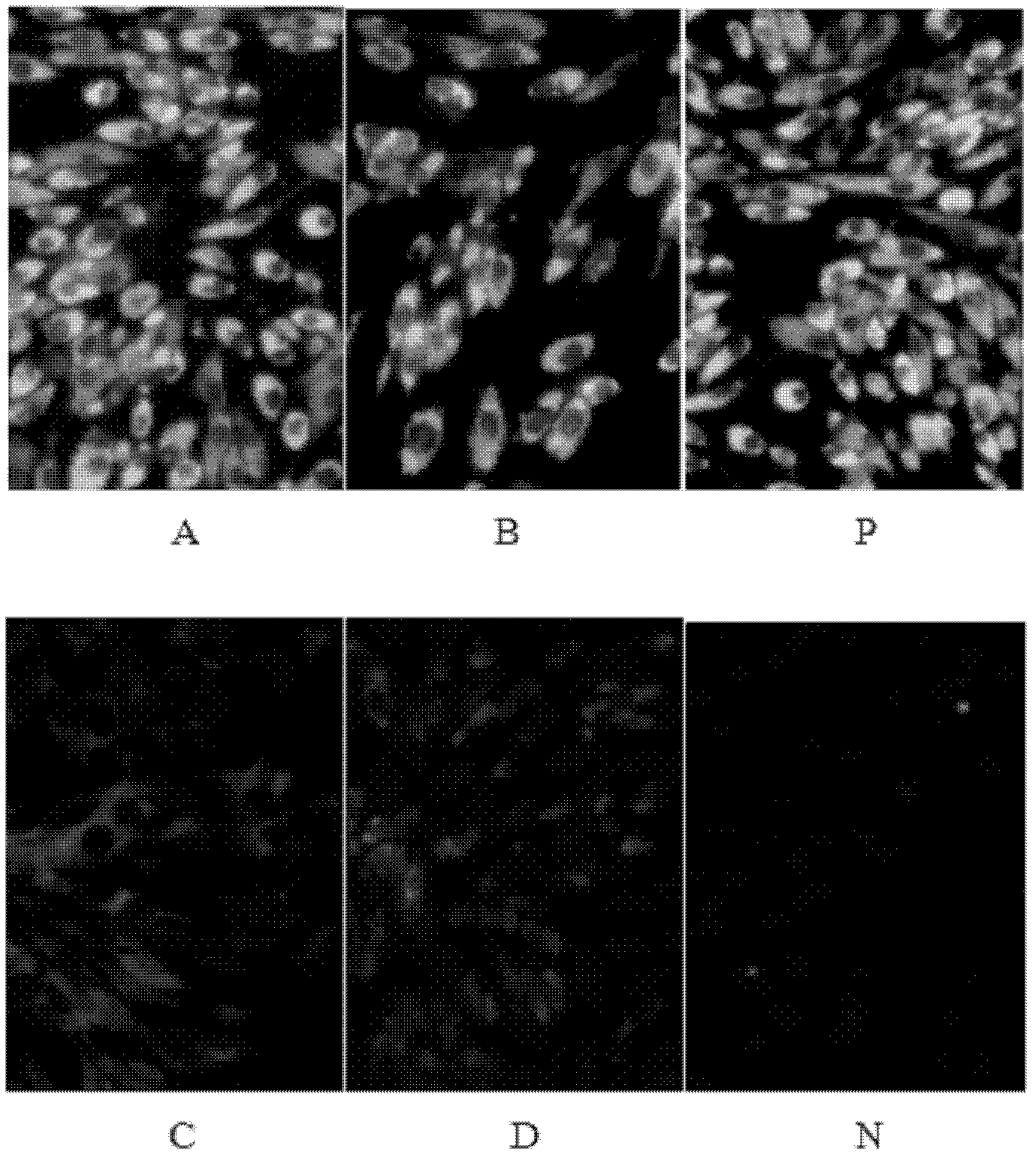 Anti-Japanese encephalitis virus monoclonal antibody and its application