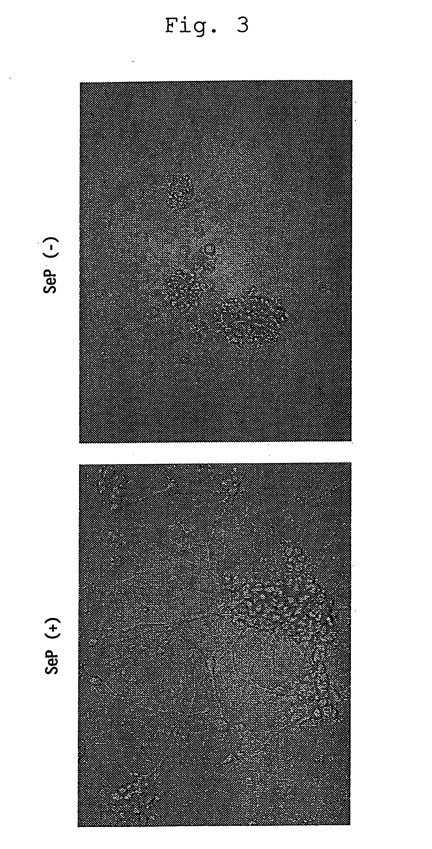 Novel agents for ameliorating motor disorder