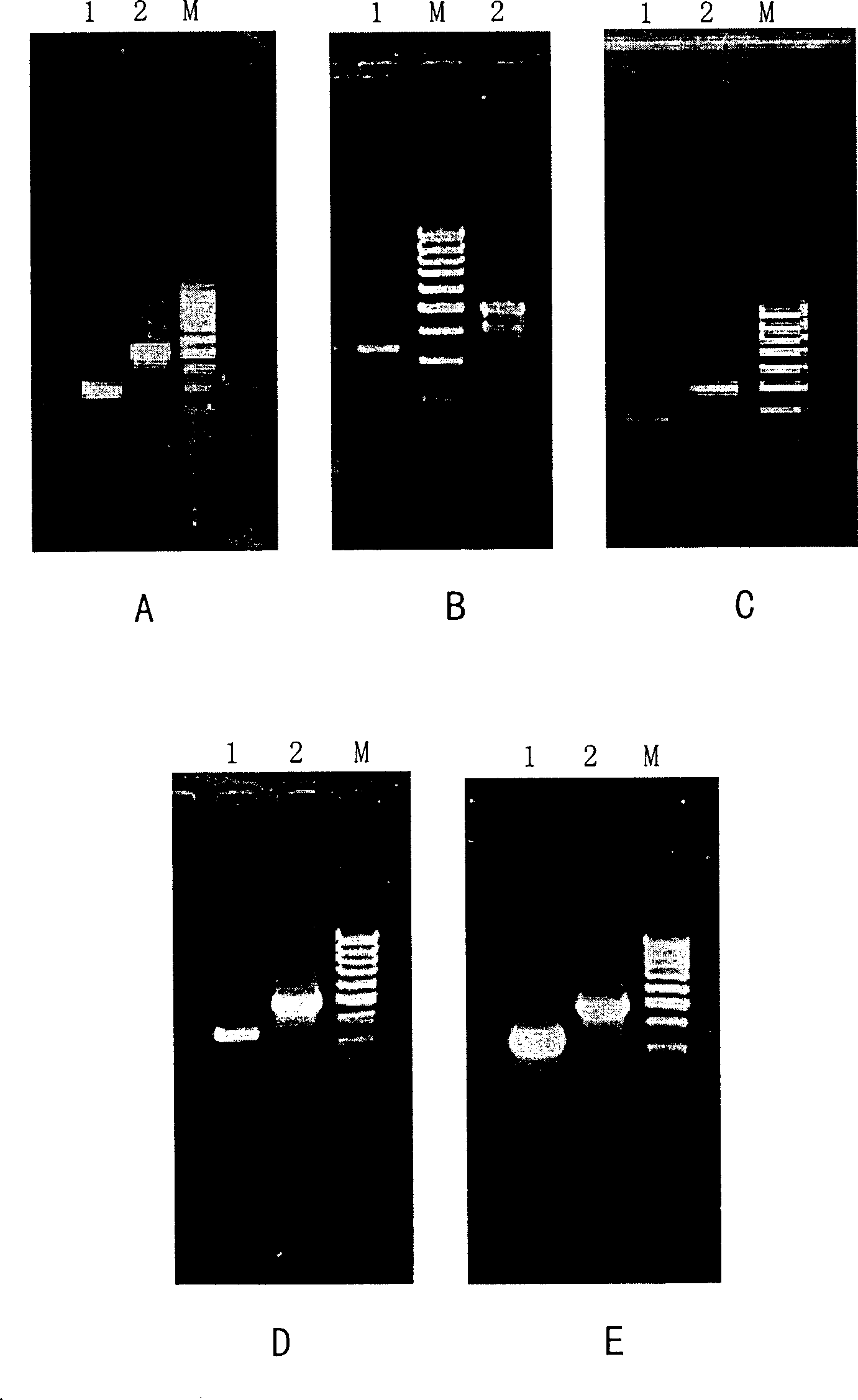 Fluorogenic quantitative PCR method for detecting gamma interferon gene expression in peripheral-blood under physiological state