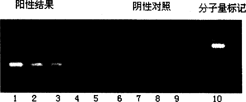 Method for detecting SARS virus and kit thereof