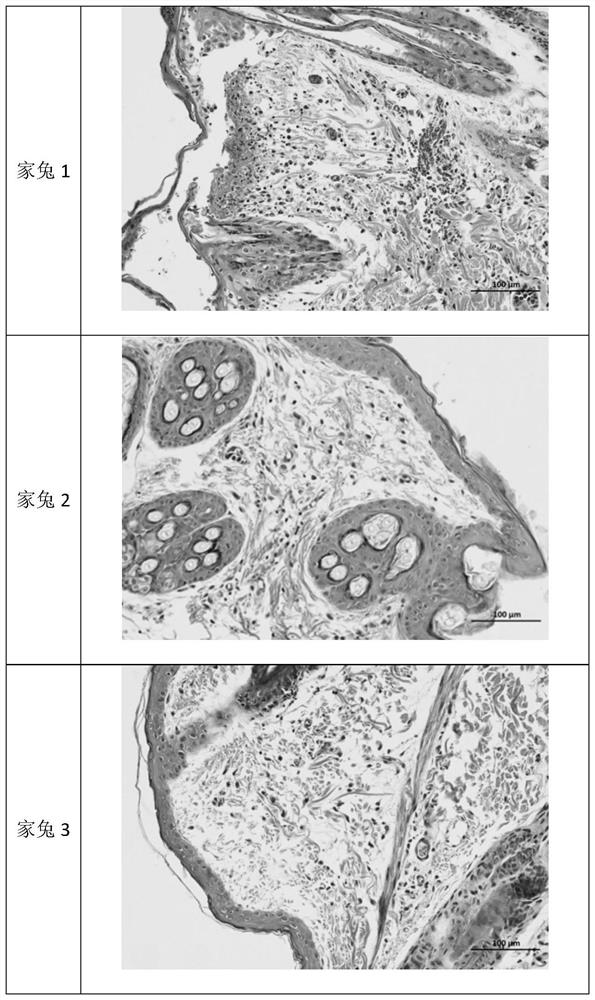 High-concentration levodopa preparation and preparation method and application thereof