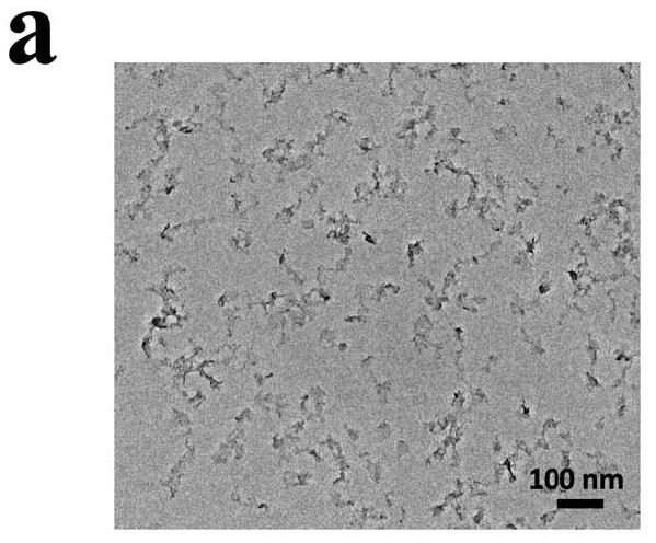 Copper peroxide transdermal microneedle system and preparation method and application thereof