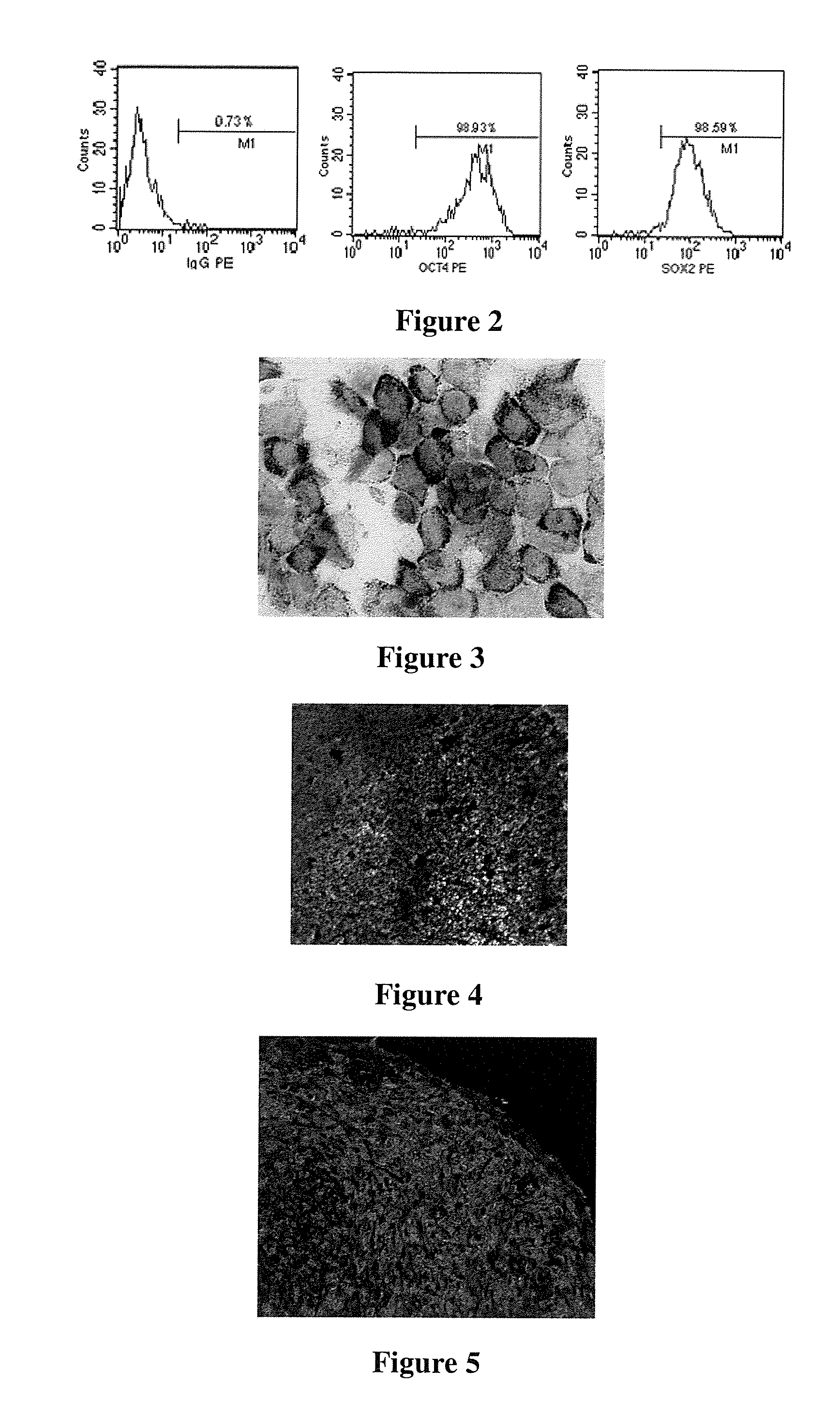 Pluripotent stem cells, method for preparation thereof and uses thereof