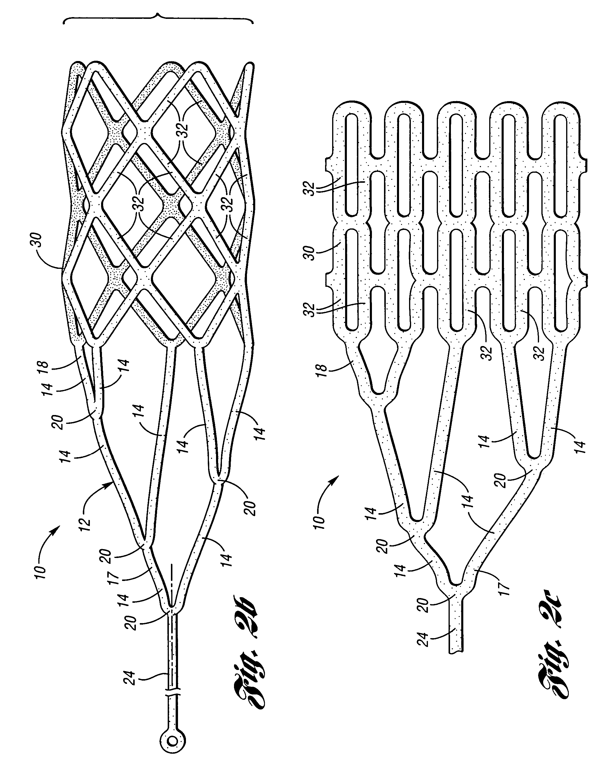 Retrievable device having a reticulation portion with staggered struts