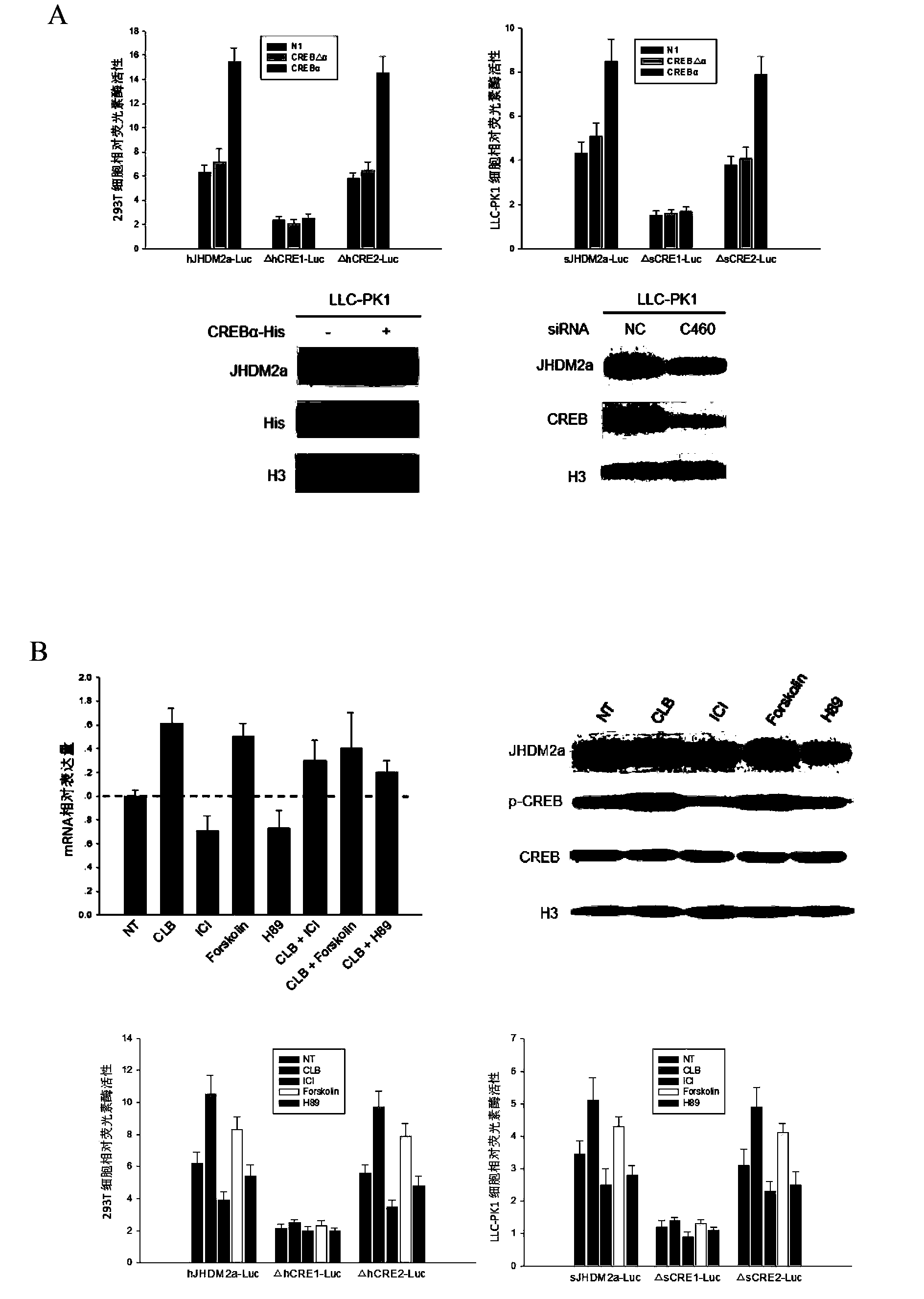 Applications of transcription factor CREB in JHDM2A gene expression regulation and pig lipid deposition reduction