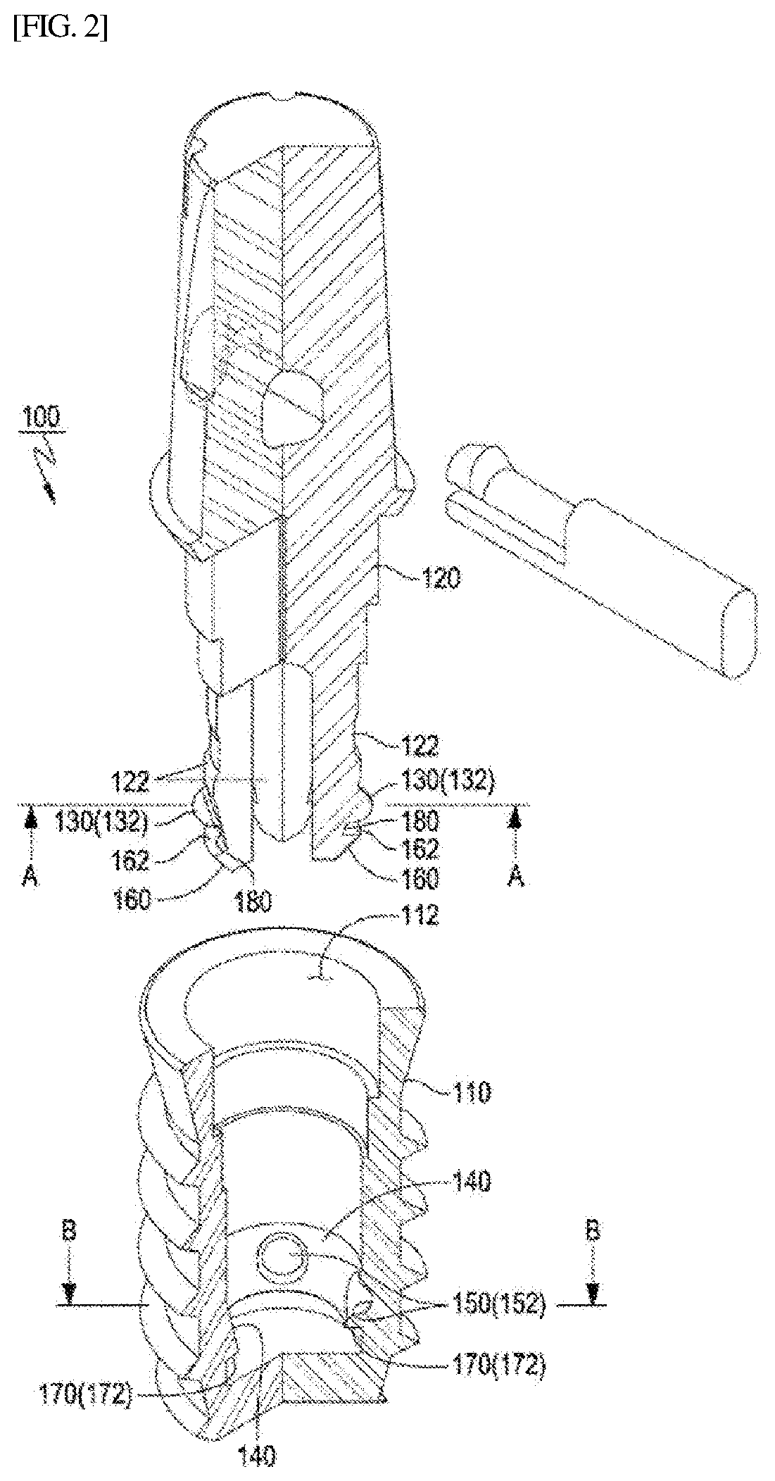 Dental implants