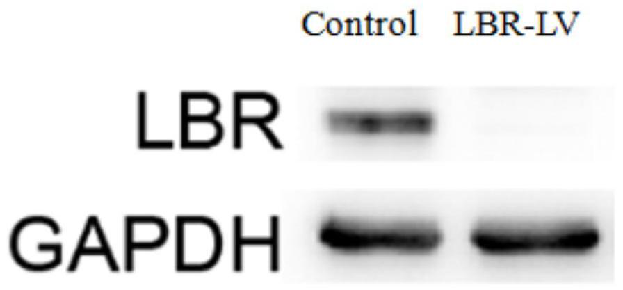 Application of nuclear membrane protein knock-down in stem cell transplantation