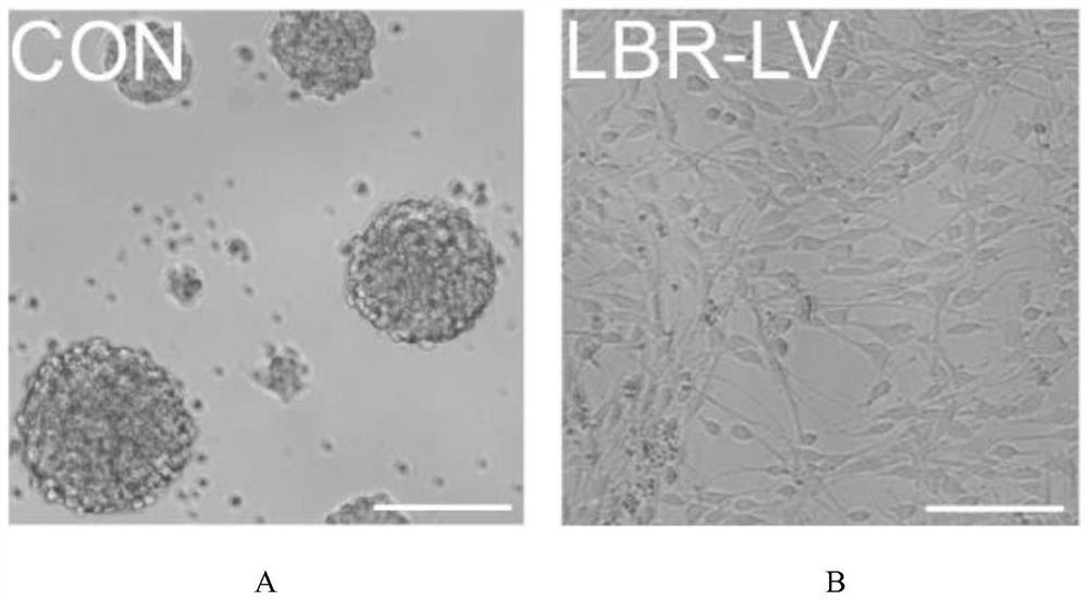 Application of nuclear membrane protein knock-down in stem cell transplantation