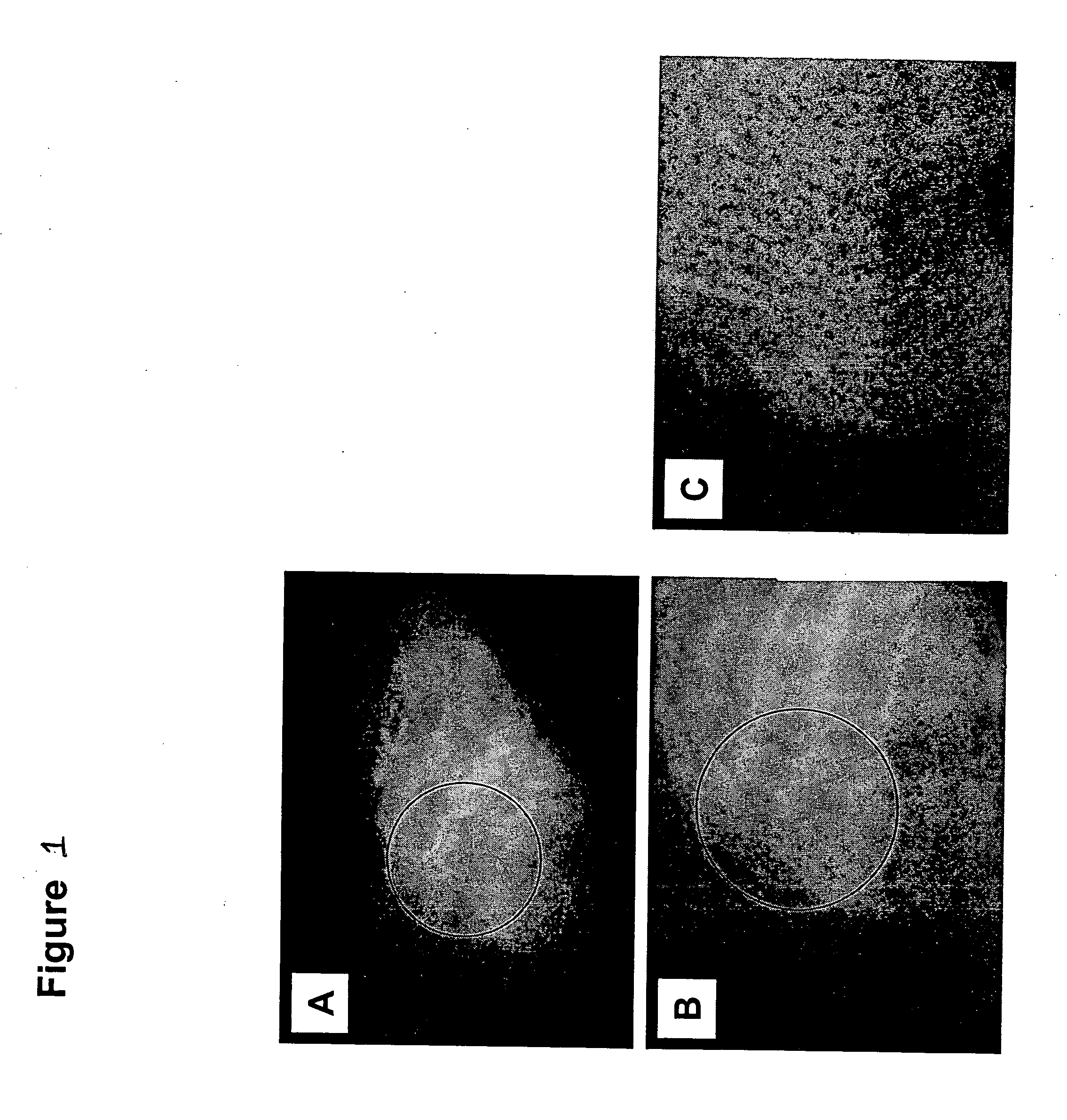 Inherently radiopaque polymeric products for embolotherapy