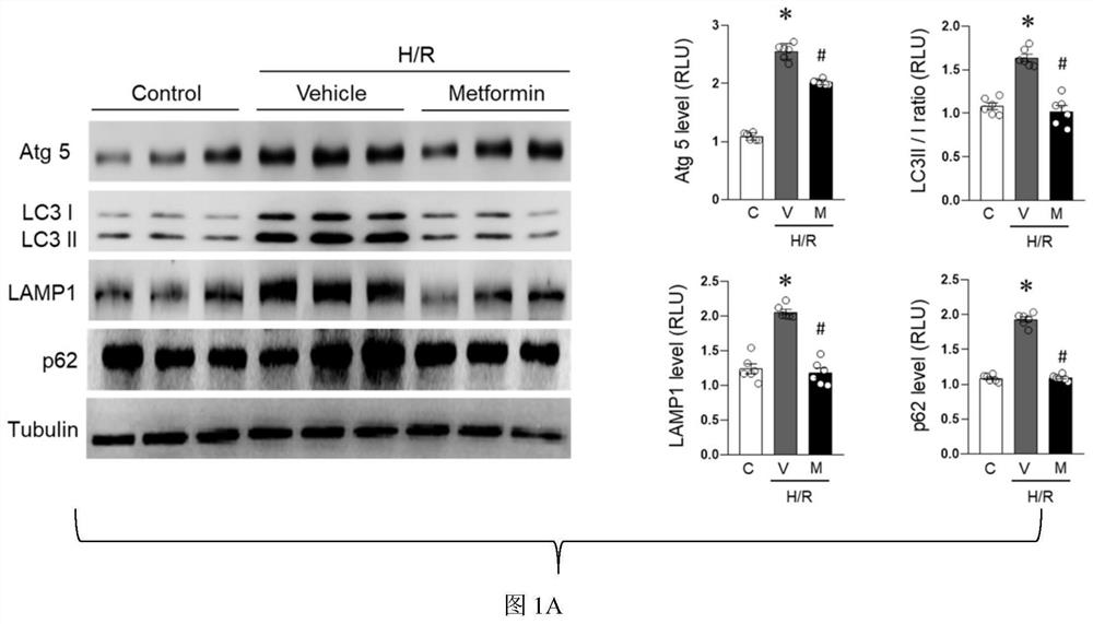 CHMP2B protein targeted inhibitor and application thereof in ischemic heart disease