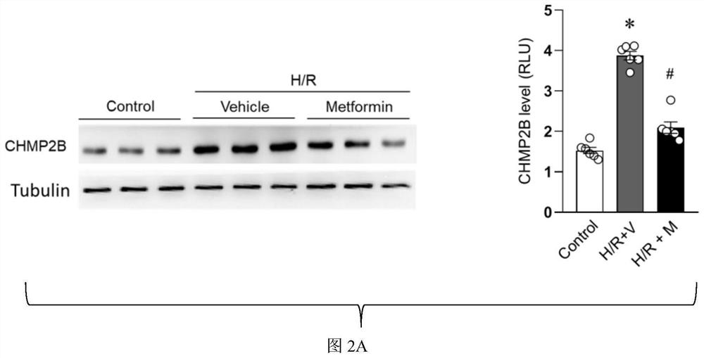 CHMP2B protein targeted inhibitor and application thereof in ischemic heart disease