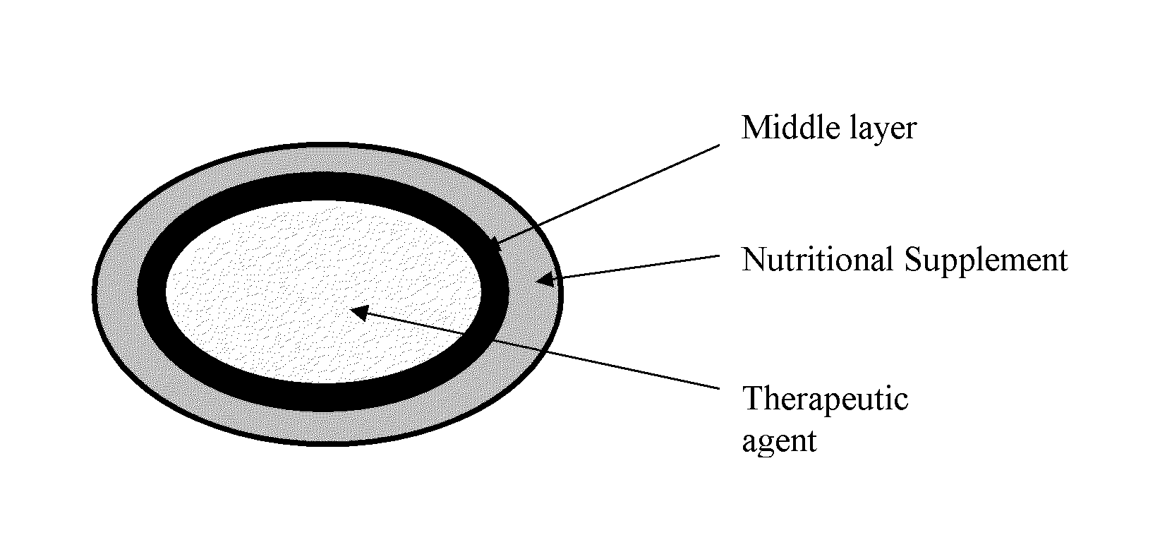 Multiple unit dosage form having a therapeutic agent in combination with a nutritional supplement