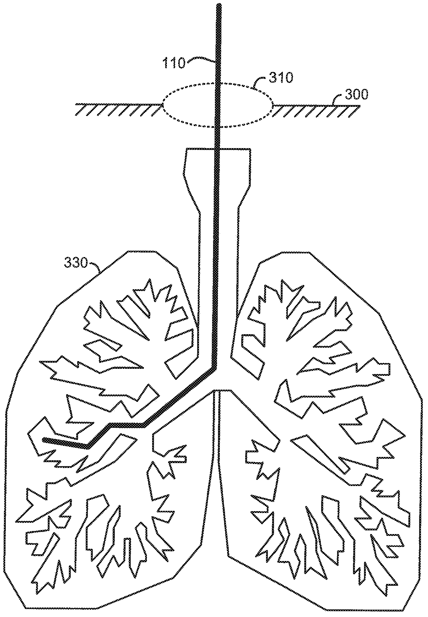 Medical system providing dynamic registration of a model of an anatomical structure for image-guided surgery