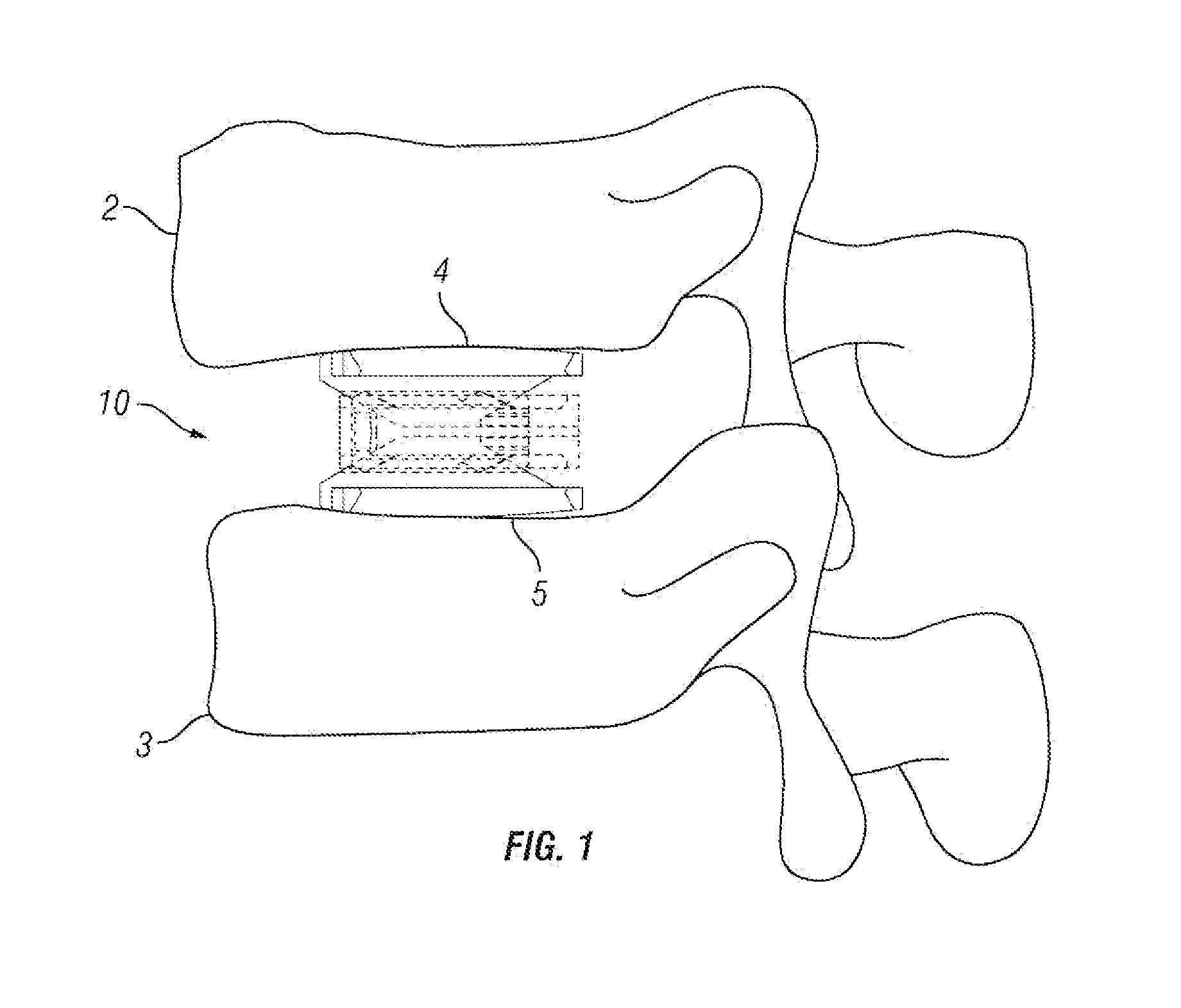 Expandable Fusion Device and Method of Installation Thereof