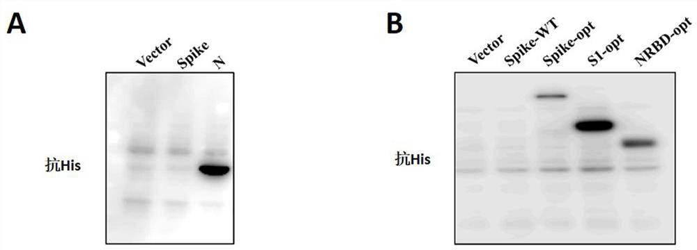 Novel vaccine for preventing COVID-19 and preparation method thereof