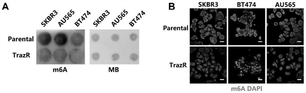 Application of RNA m6A methylation detection reagent in preparation of product for predicting breast cancer anti-HER2 treatment effect